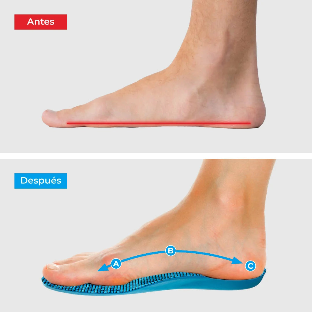 Plantillas ComfyFeet™️ - Disfruta de días sin dolor, sin tratamientos caros ni visitas al médico
