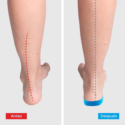 Plantillas ComfyFeet™️ - Disfruta de días sin dolor, sin tratamientos caros ni visitas al médico